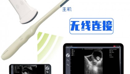 招标采购无线羊智能B超GDF-A15报价价格羊B超厂家品牌